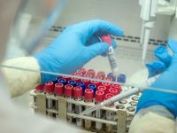 121 de cazuri de infecţie cu SARS-CoV-2 în ţară