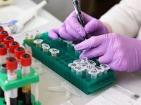 În cazul unui grup de francezi cu suspiciune de toxiinfecţie alimentară, probele de apă şi aliment sunt conforme